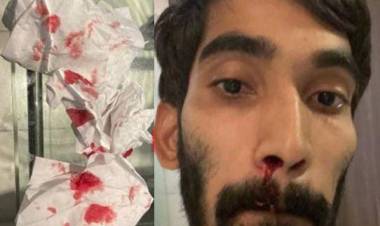 തുടരെ നാല് കൊവിഡ് ടെസ്റ്റ് : മൂക്കില് നിന്ന് രക്തം വാര്ന്ന് ഇന്ത്യന് ബാഡ്മിന്റണ് താരം
