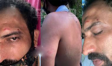 ‘നെറ്റിയിലും നെഞ്ചിലും മെഷീൻവച്ച് ഇടിച്ചു’; ടോൾ ബൂത്തിൽ യുവാവിന് ജീവനക്കാരുടെ മർദനം