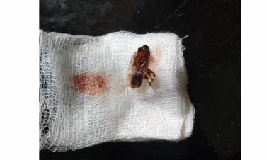 ചെവിയിൽ പാറ്റകയറിയ വിദ്യാർത്ഥിയെ ചികിത്സിച്ചില്ല, ഡോക്ടർക്കെതിരെ പരാതി.